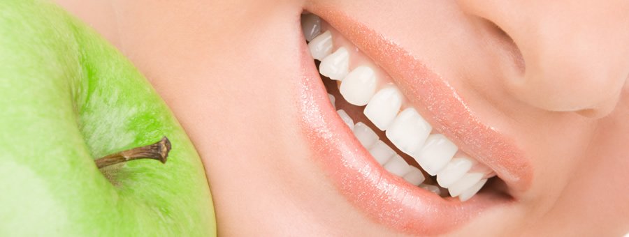sonrisa con blanqueamiento